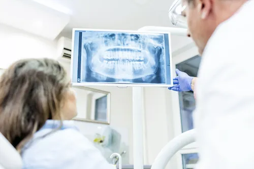 Digital Dental X-Rays in Cambridge, MA